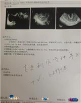 怎么樣弄個假的懷孕檢查報告