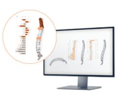M360脊柱形態(tài)功能評估儀
